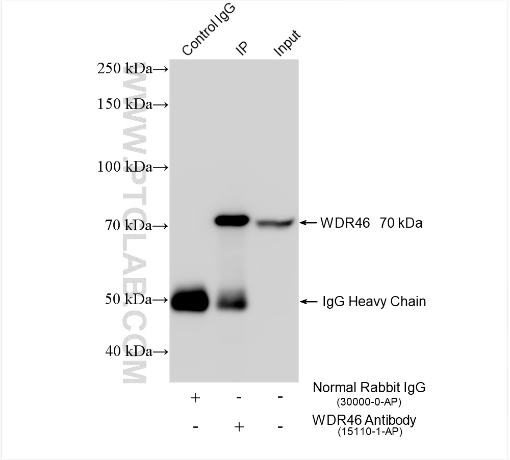 Immunoprecipitation (IP) experiment of Jurkat cells using WDR46 Polyclonal antibody (15110-1-AP)