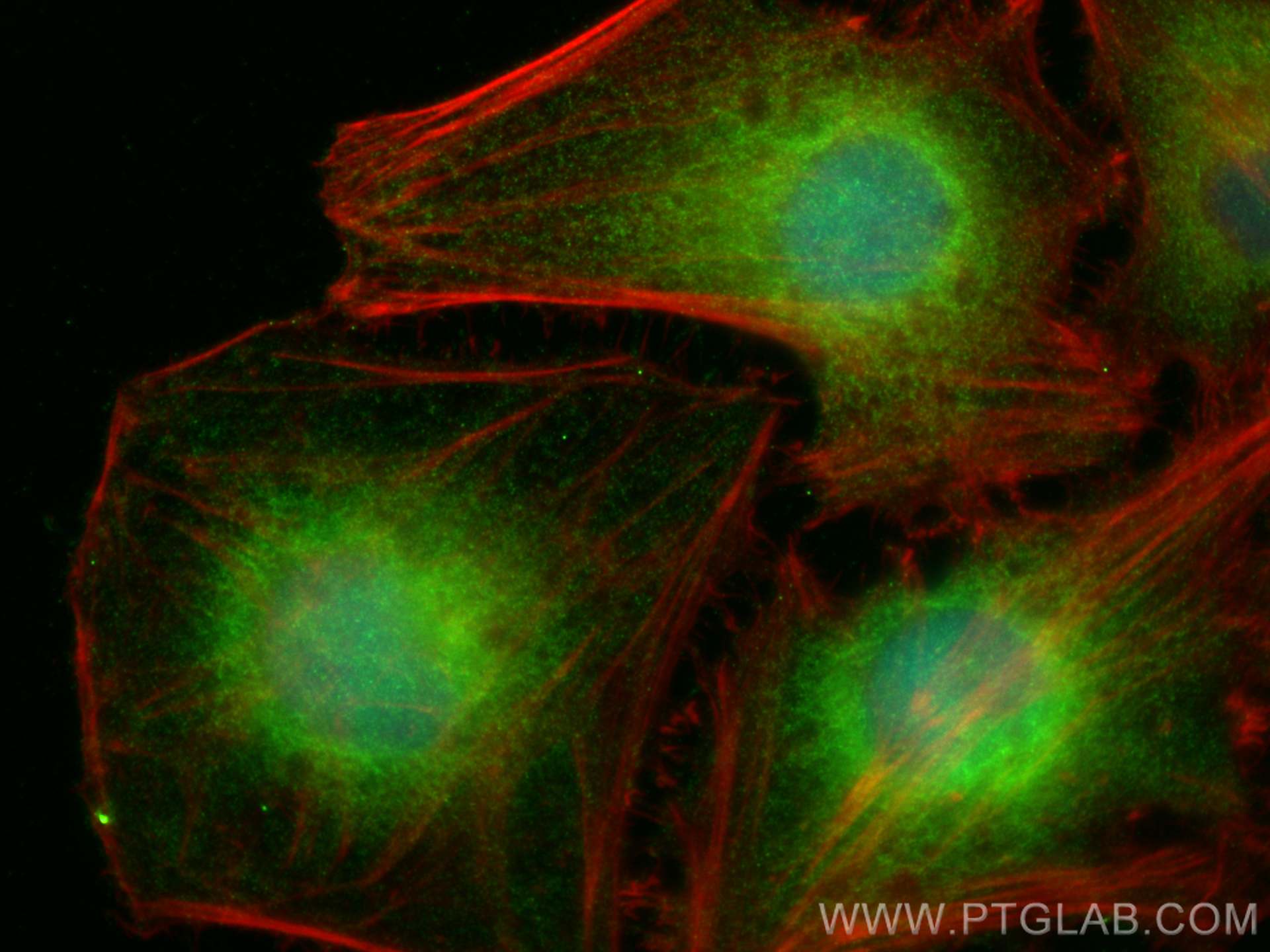 Immunofluorescence (IF) / fluorescent staining of HeLa cells using WDR61 Polyclonal antibody (22536-1-AP)