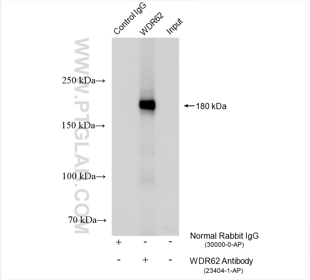 Immunoprecipitation (IP) experiment of HEK-293T cells using WDR62 Polyclonal antibody (23404-1-AP)