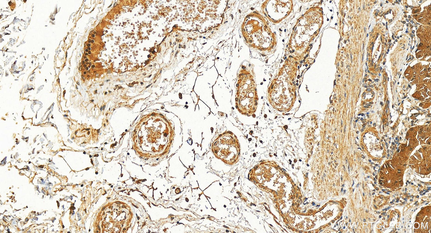 Immunohistochemistry (IHC) staining of human stomach tissue using WDR77 Polyclonal antibody (10115-1-AP)