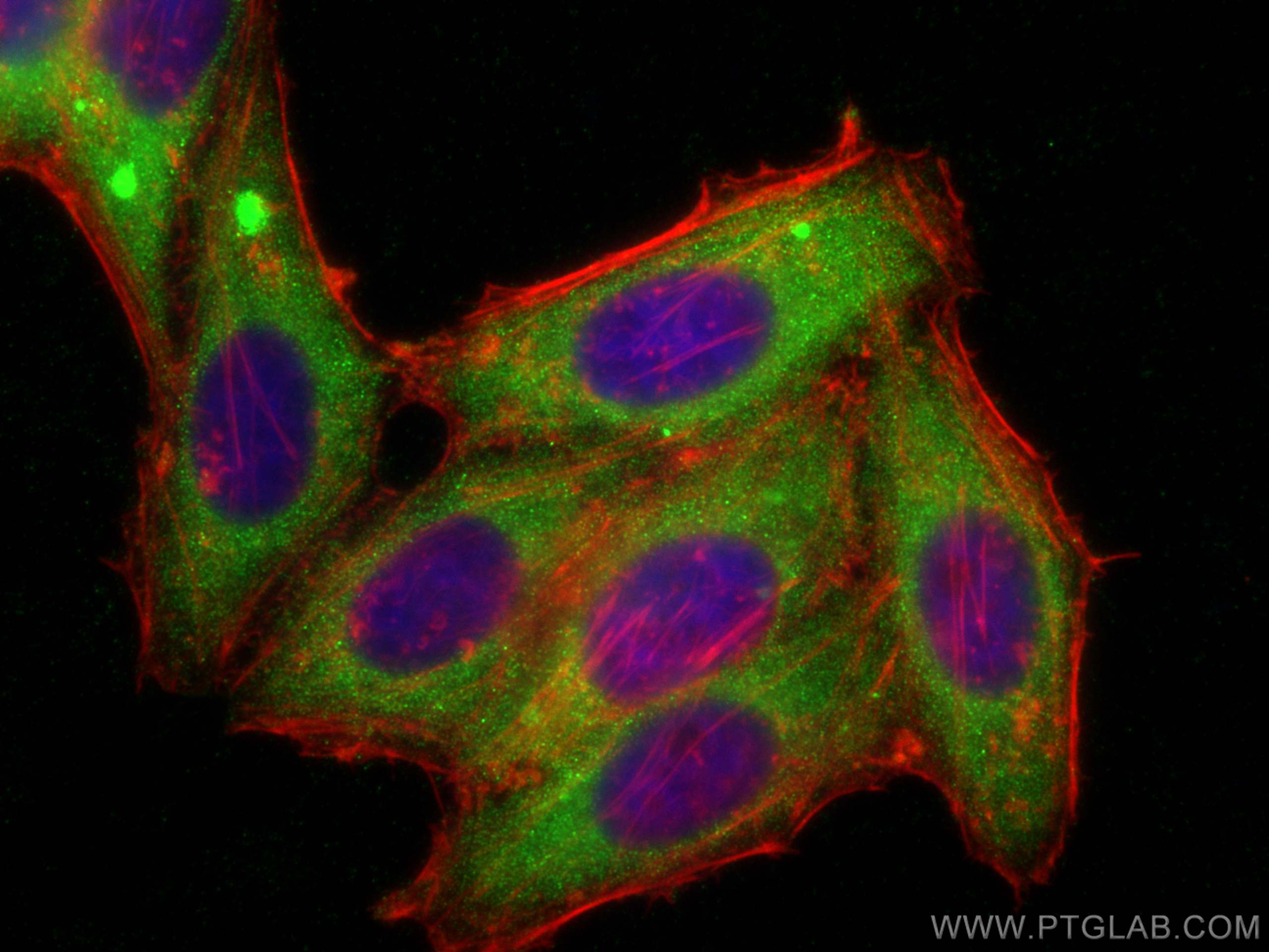 Immunofluorescence (IF) / fluorescent staining of HepG2 cells using WDR81 Polyclonal antibody (24874-1-AP)