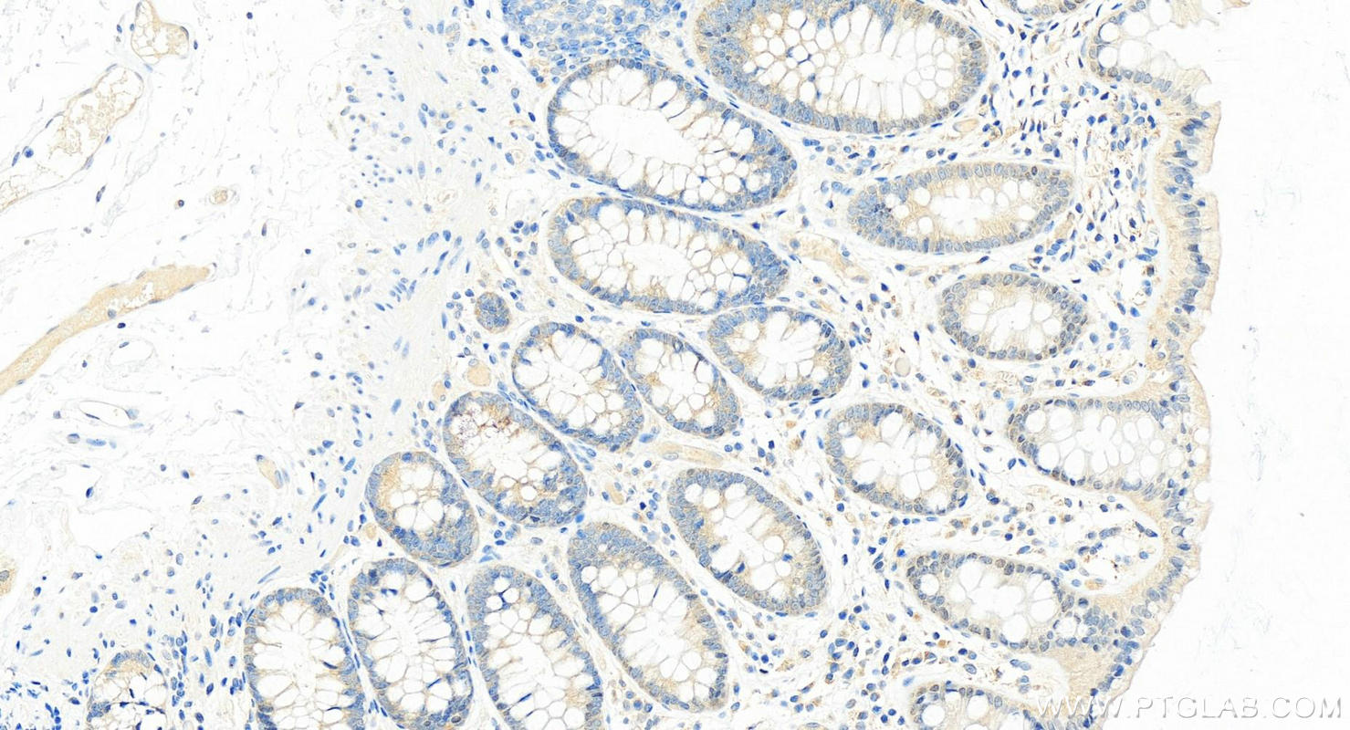 Immunohistochemistry (IHC) staining of human colon tissue using WDR92 Polyclonal antibody (25540-1-AP)