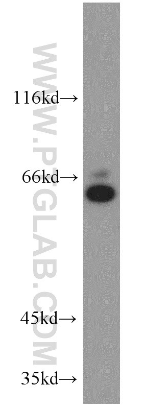 Western Blot (WB) analysis of Jurkat cells using WEE2 Polyclonal antibody (55119-1-AP)