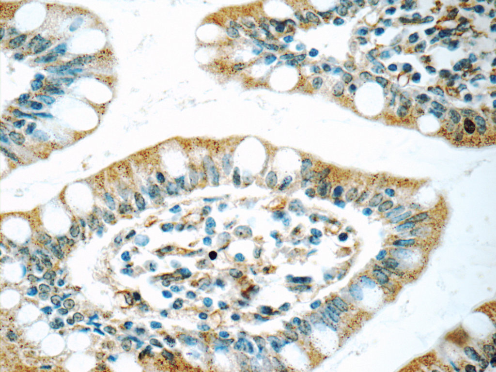 Immunohistochemistry (IHC) staining of human small intestine tissue using WFDC1 Polyclonal antibody (13204-1-AP)