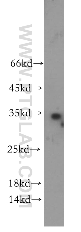 Western Blot (WB) analysis of PC-3 cells using WFDC1 Polyclonal antibody (13204-1-AP)