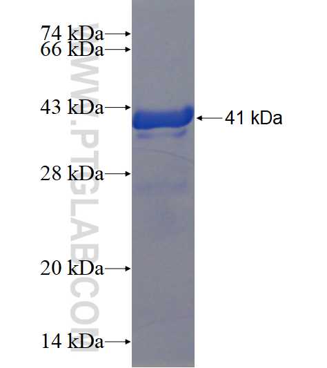 WFDC1 fusion protein Ag3960 SDS-PAGE