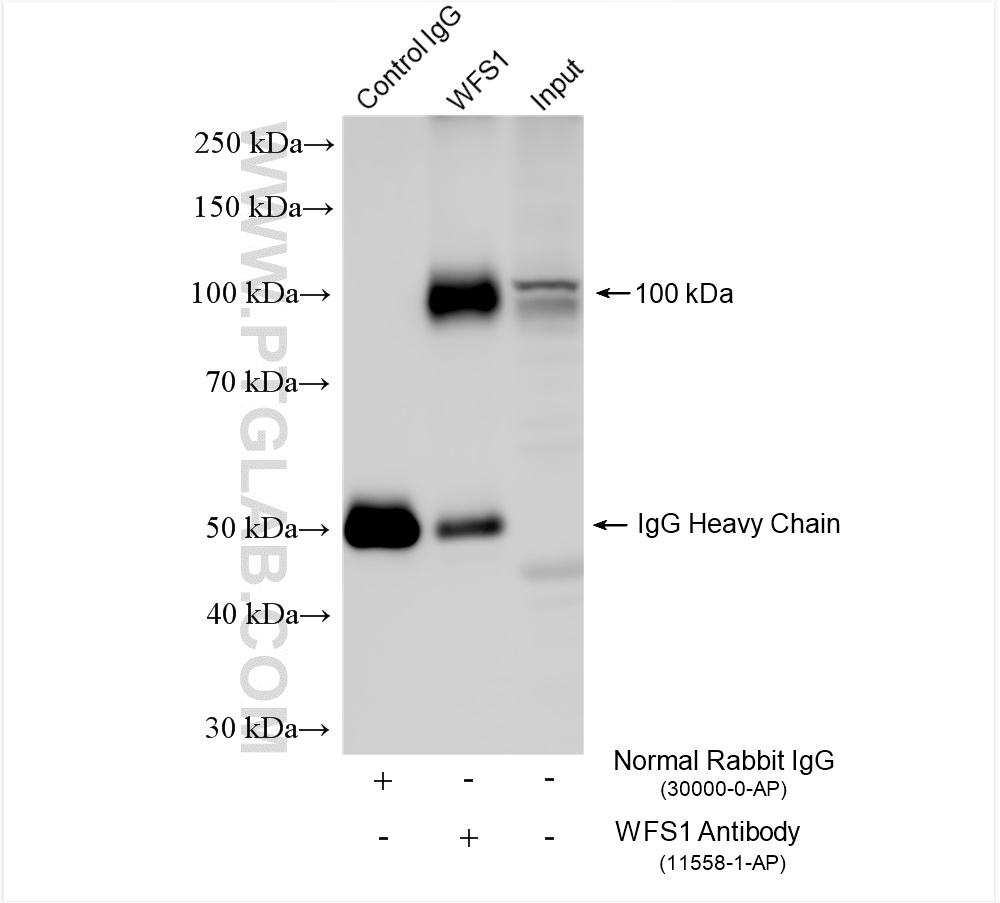 Immunoprecipitation (IP) experiment of SH-SY5Y cells using WFS1 Polyclonal antibody (11558-1-AP)