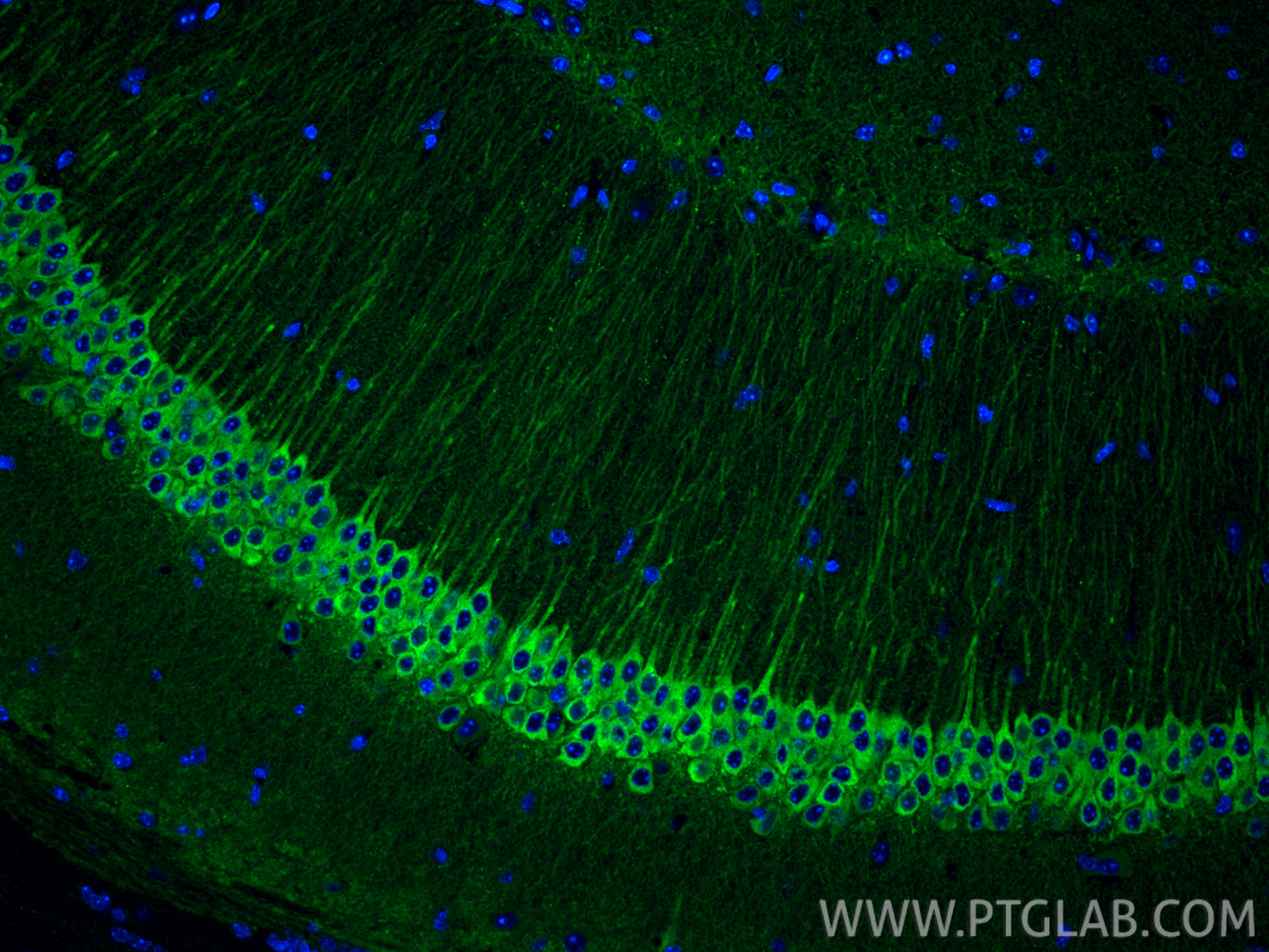Immunofluorescence (IF) / fluorescent staining of mouse brain tissue using WFS1 Polyclonal antibody (26995-1-AP)
