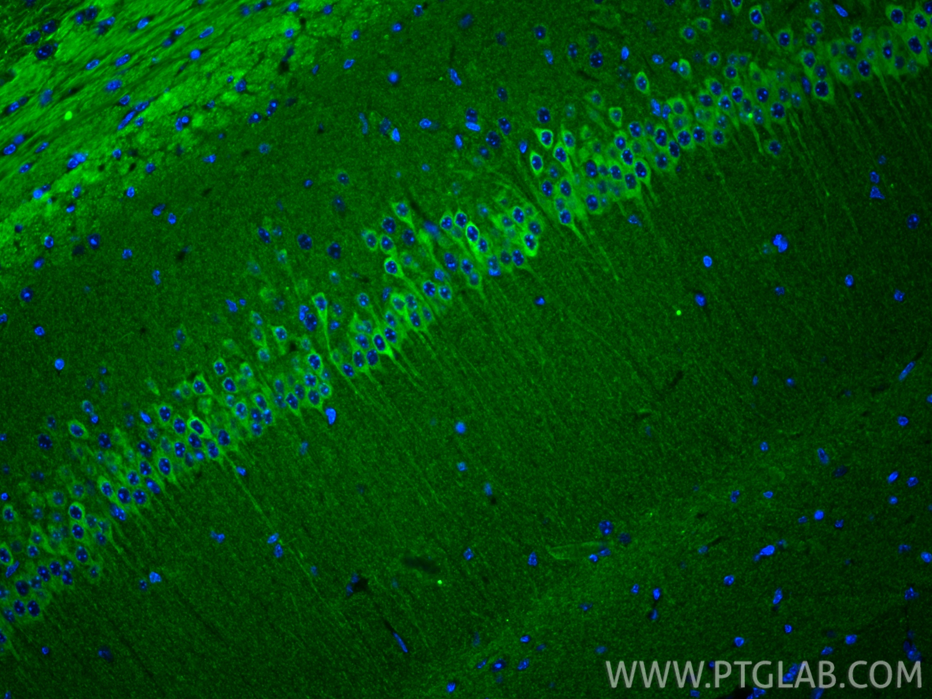 Immunofluorescence (IF) / fluorescent staining of mouse brain tissue using WFS1 Polyclonal antibody (26995-1-AP)