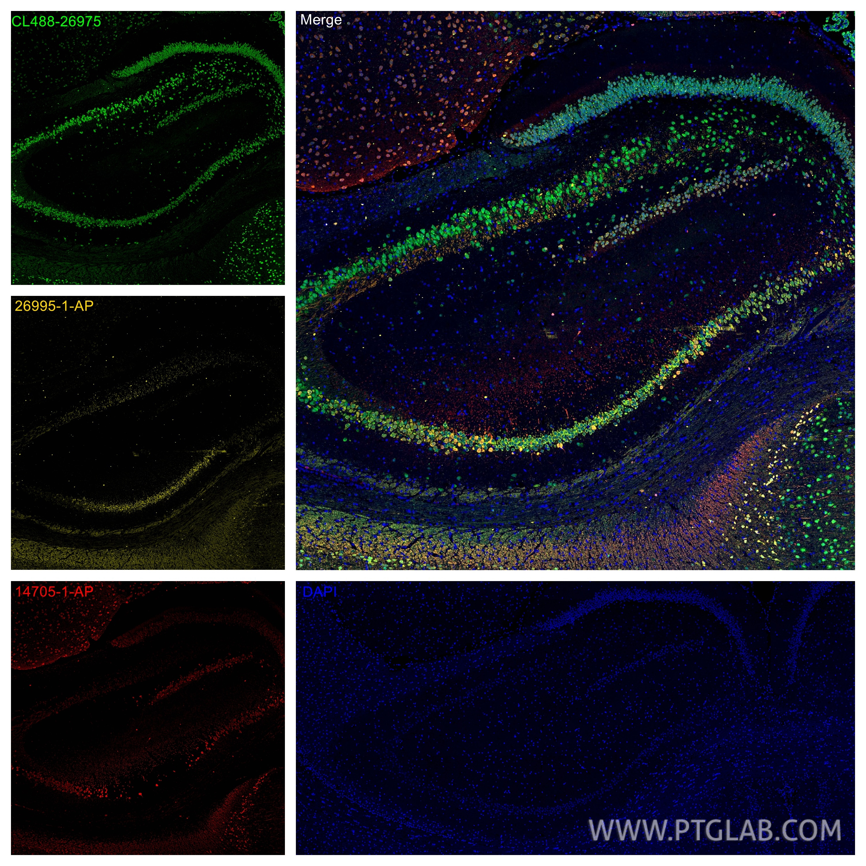 Immunofluorescence (IF) / fluorescent staining of rat brain tissue using WFS1 Polyclonal antibody (26995-1-AP)