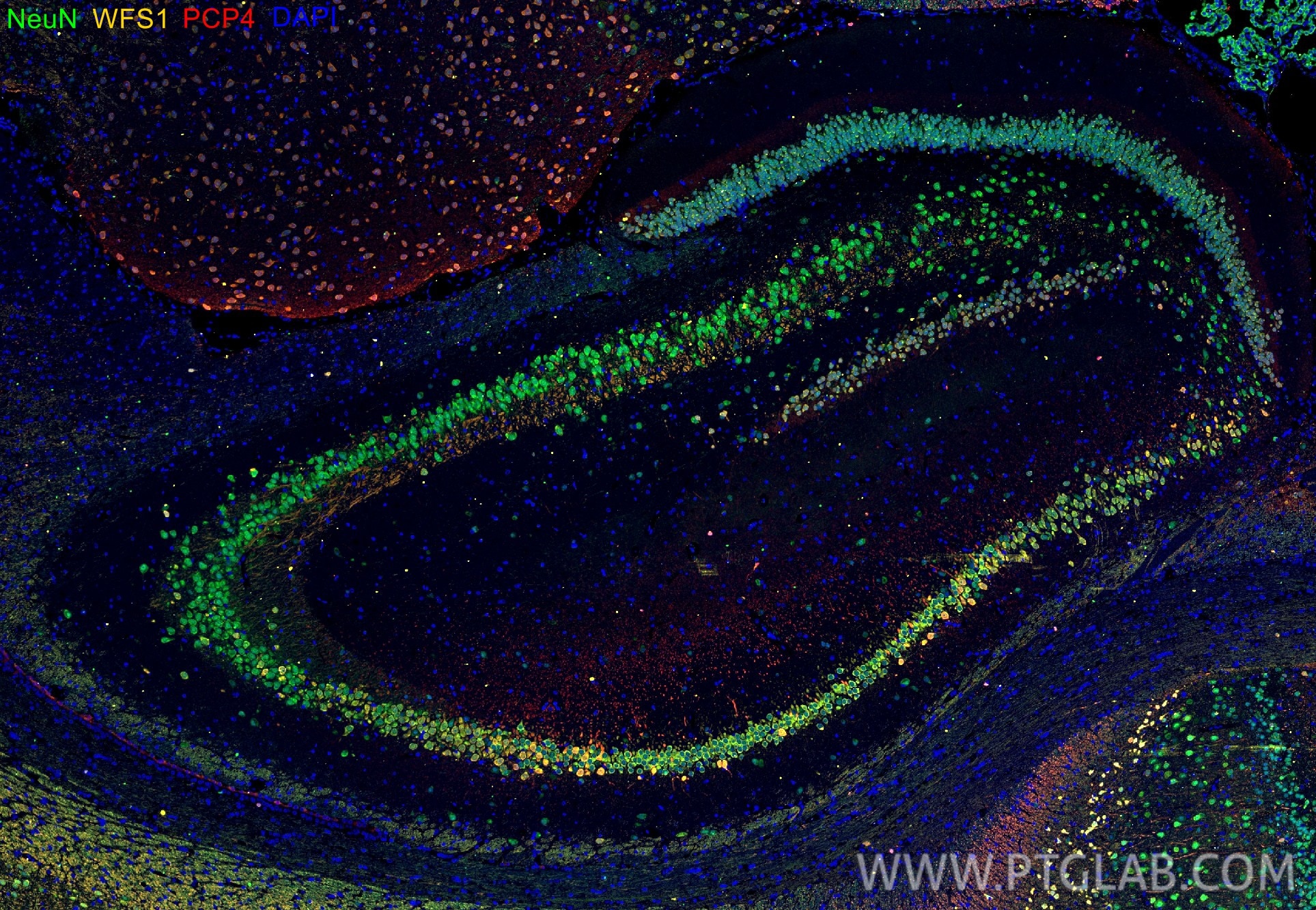 Immunofluorescence (IF) / fluorescent staining of rat brain tissue using WFS1 Polyclonal antibody (26995-1-AP)