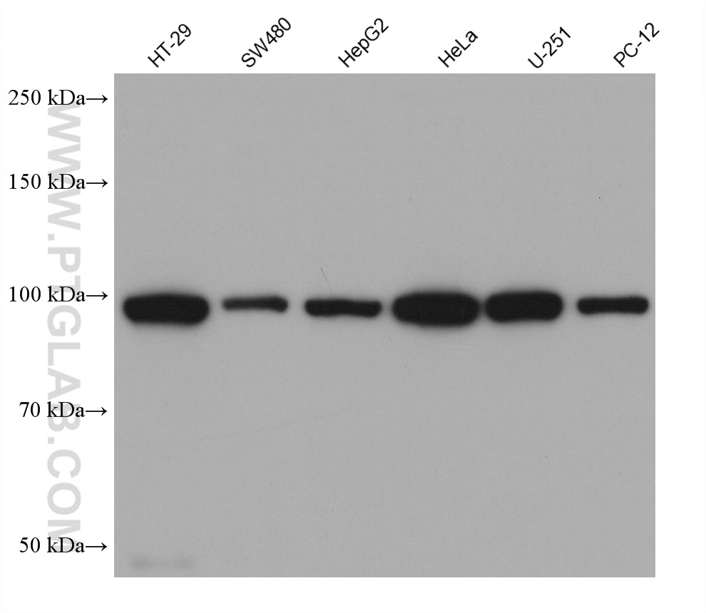 Western Blot (WB) analysis of various lysates using WFS1 Monoclonal antibody (67291-1-Ig)