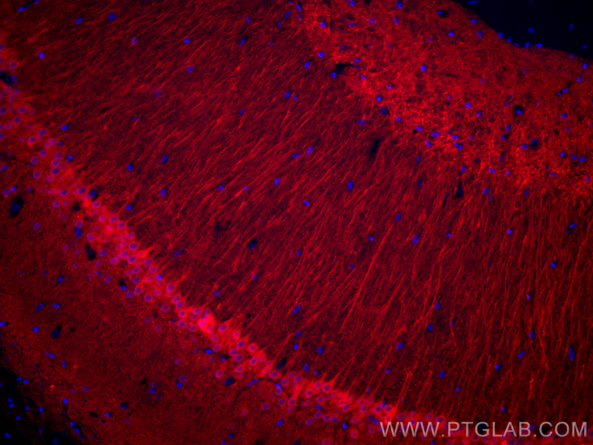 Immunofluorescence (IF) / fluorescent staining of rat brain tissue using CoraLite® Plus 594-conjugated WFS1 Polyclonal anti (CL594-26995)