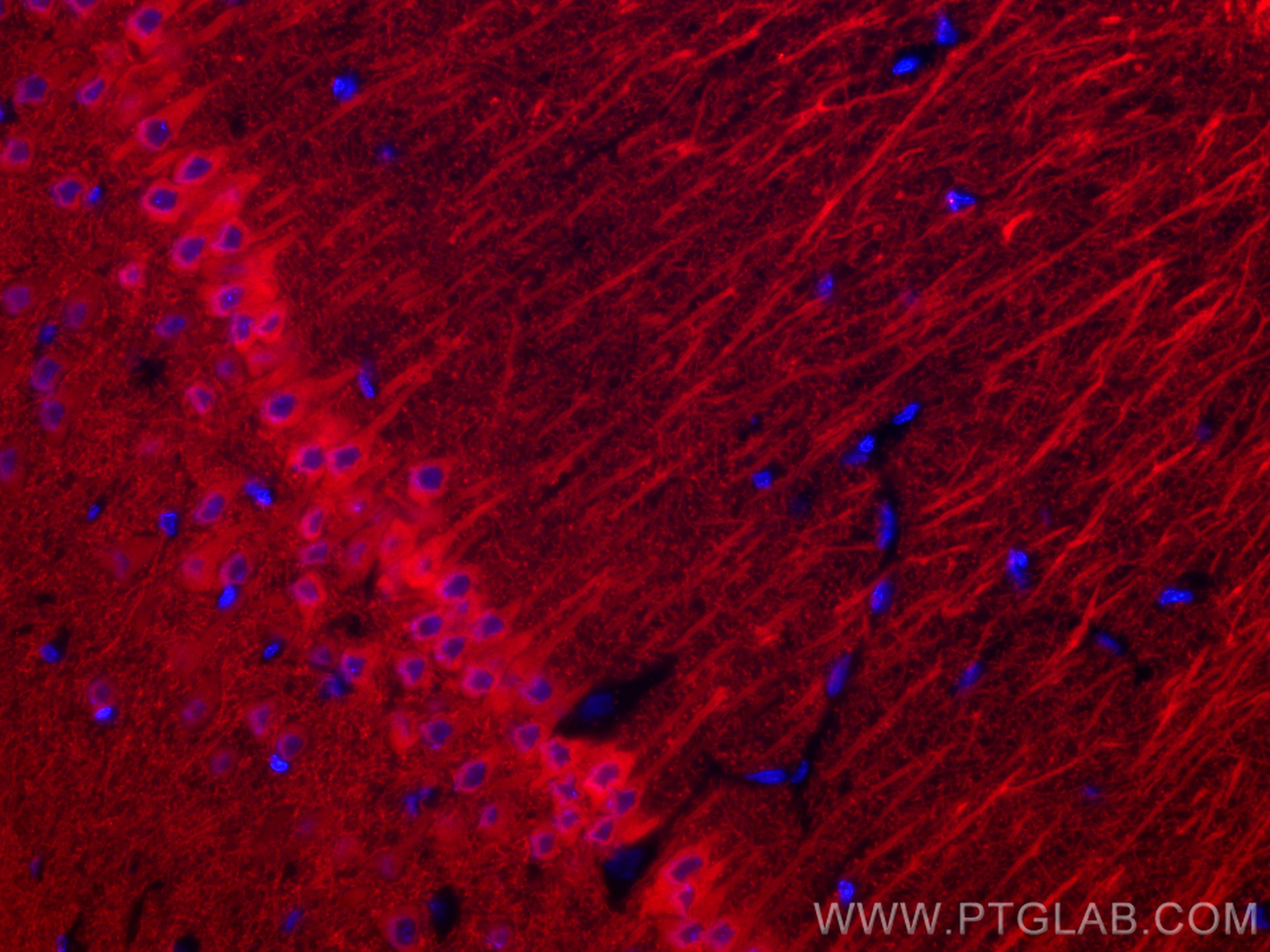 Immunofluorescence (IF) / fluorescent staining of rat brain tissue using CoraLite® Plus 594-conjugated WFS1 Polyclonal anti (CL594-26995)