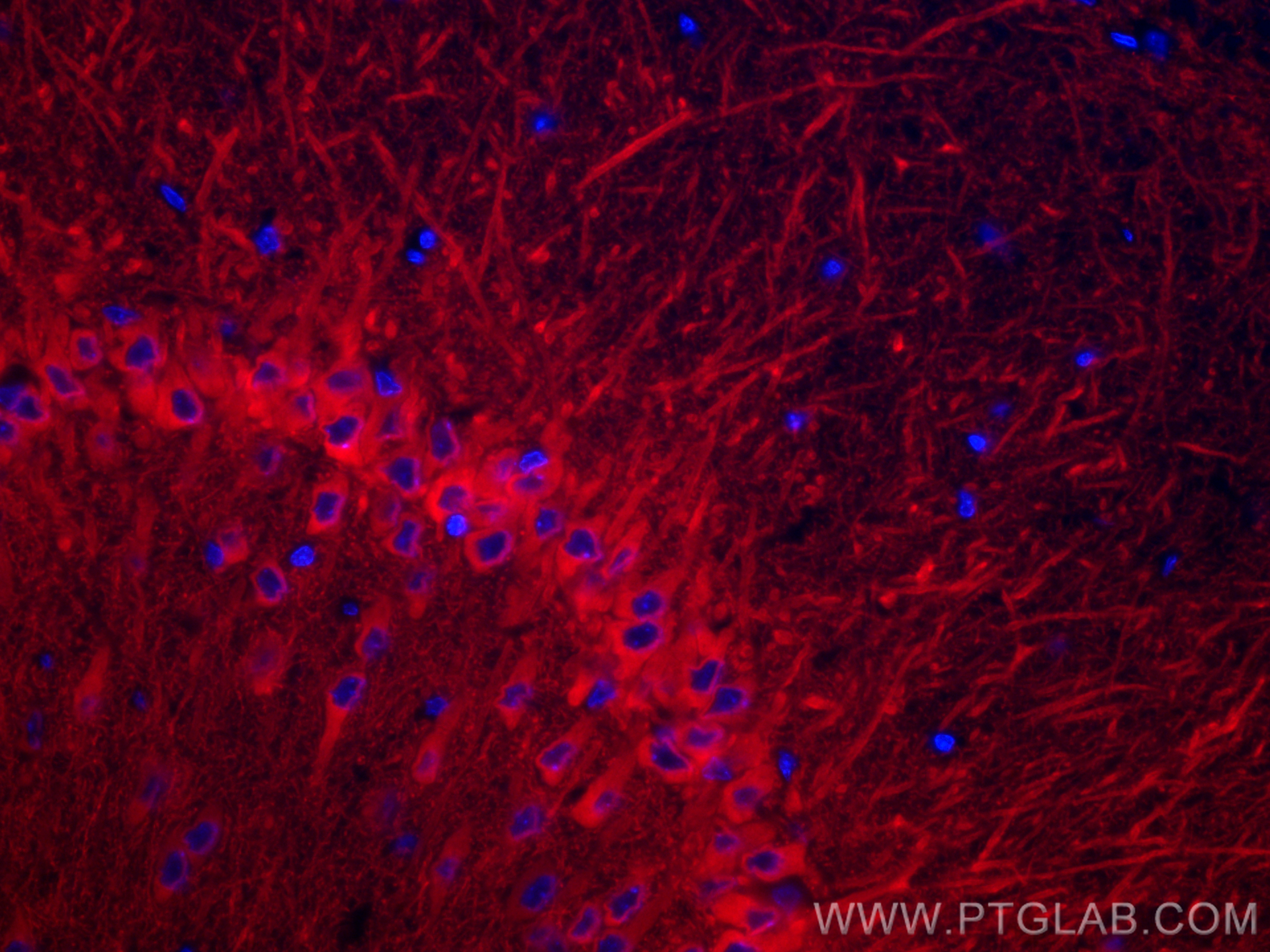 Immunofluorescence (IF) / fluorescent staining of rat brain tissue using CoraLite® Plus 594-conjugated WFS1 Polyclonal anti (CL594-26995)