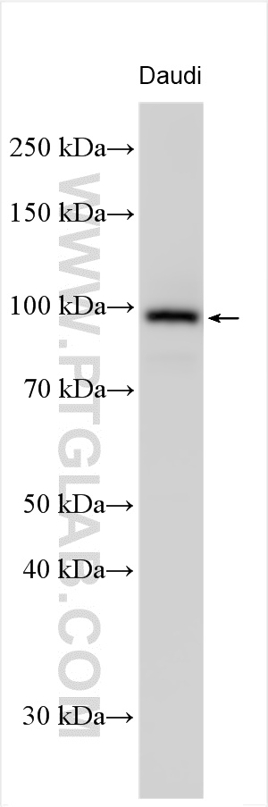 Western Blot (WB) analysis of various lysates using WHAMM Polyclonal antibody (31572-1-AP)