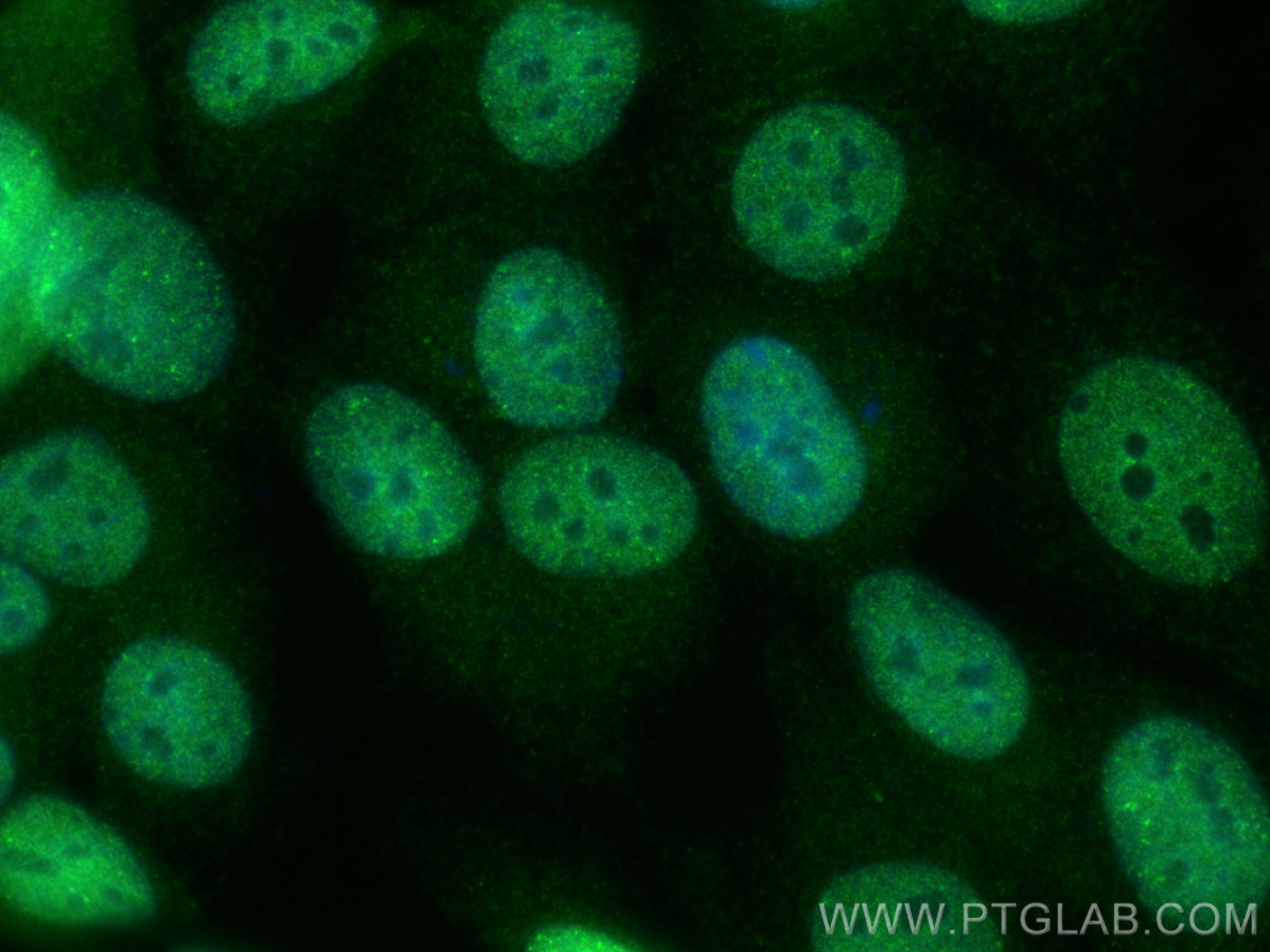 Immunofluorescence (IF) / fluorescent staining of MCF-7 cells using NSD3 Polyclonal antibody (11345-1-AP)