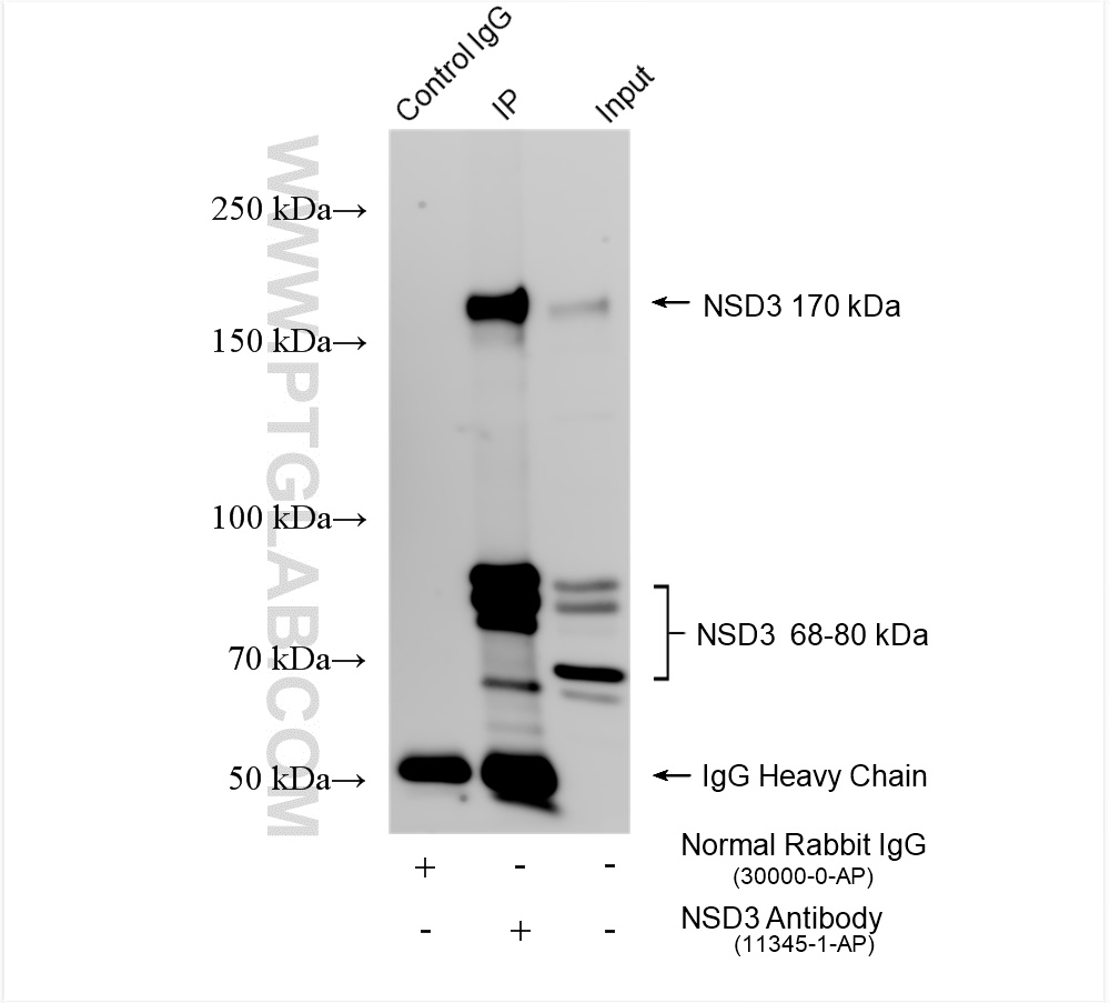 Immunoprecipitation (IP) experiment of HeLa cells using NSD3 Polyclonal antibody (11345-1-AP)