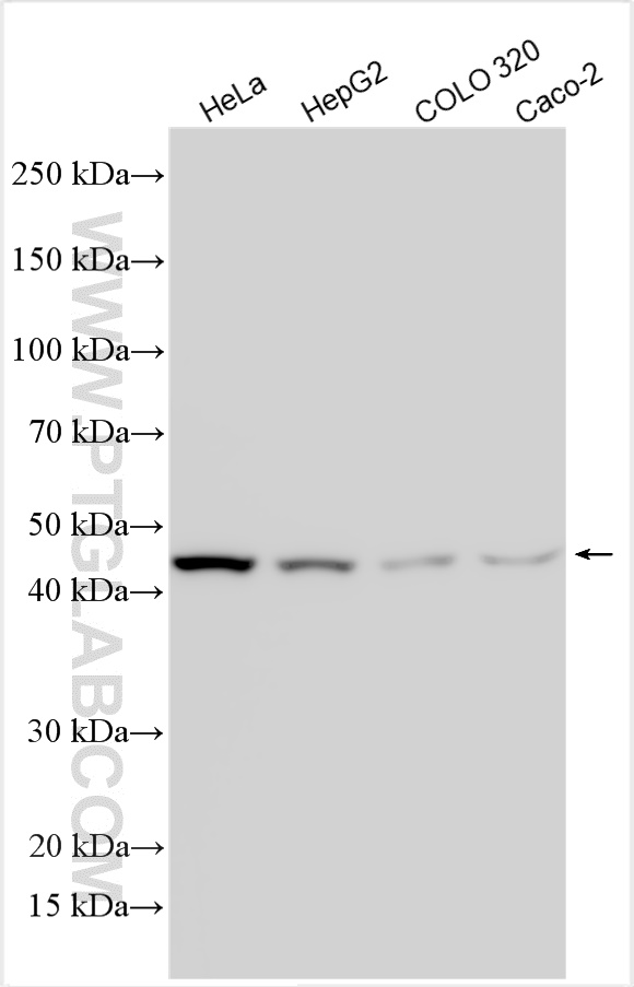 Western Blot (WB) analysis of various lysates using WISP3 Polyclonal antibody (26406-1-AP)