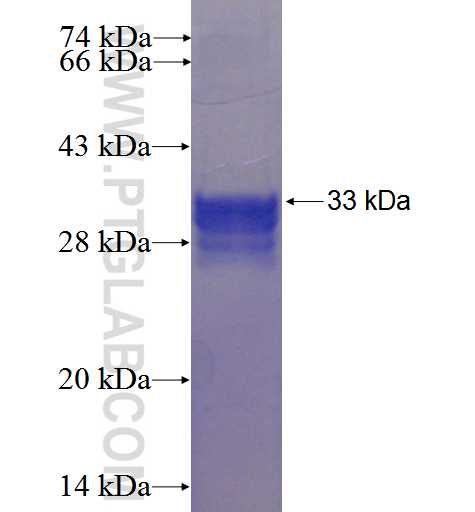 WISP3 fusion protein Ag23999 SDS-PAGE