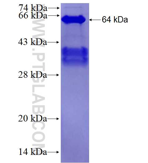 WNK1 fusion protein Ag28034 SDS-PAGE