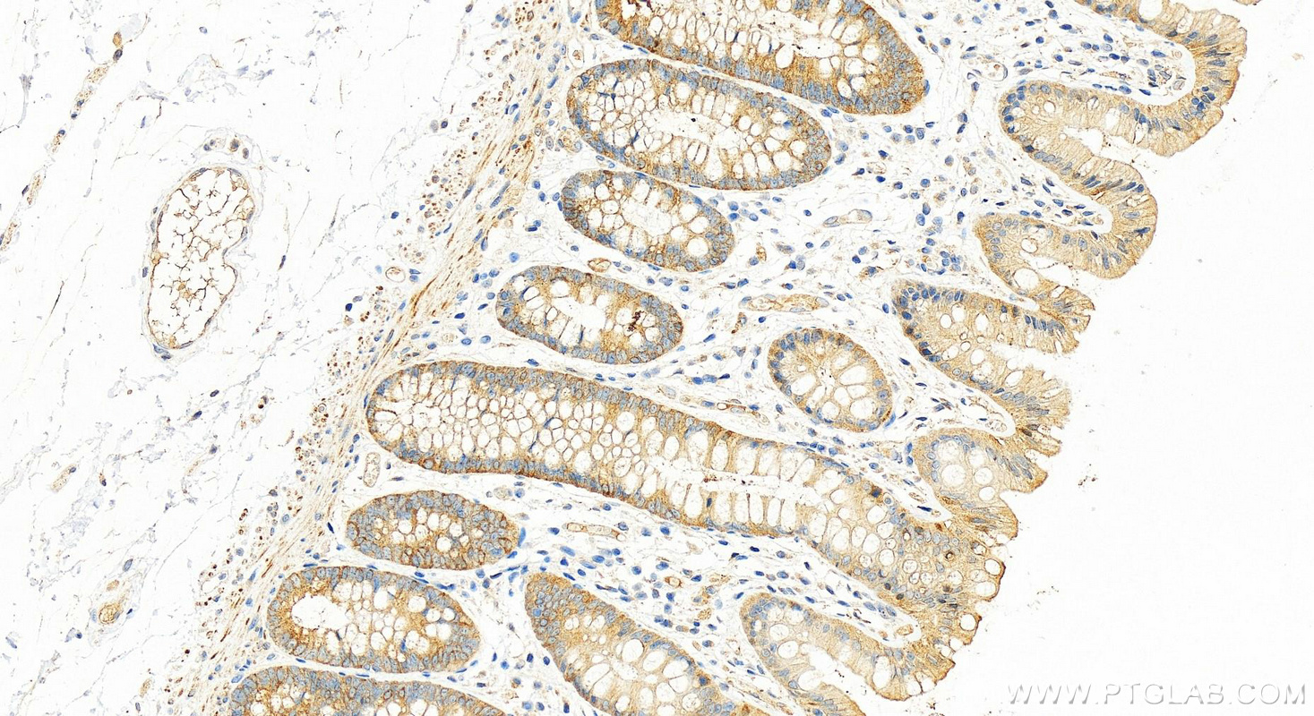 Immunohistochemistry (IHC) staining of human colon tissue using WNK4 Polyclonal antibody (22326-1-AP)