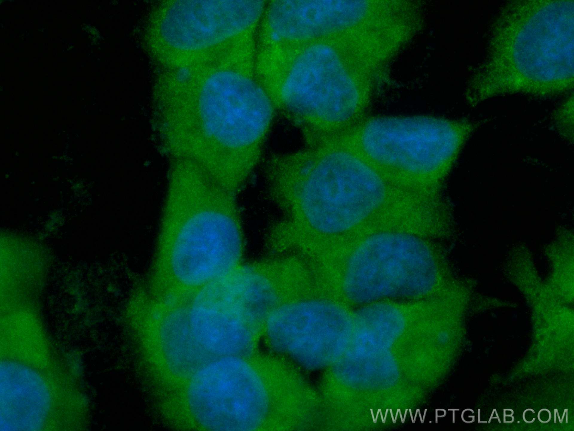 Immunofluorescence (IF) / fluorescent staining of MCF-7 cells using CoraLite® Plus 488-conjugated WNT2 Polyclonal anti (CL488-27214)