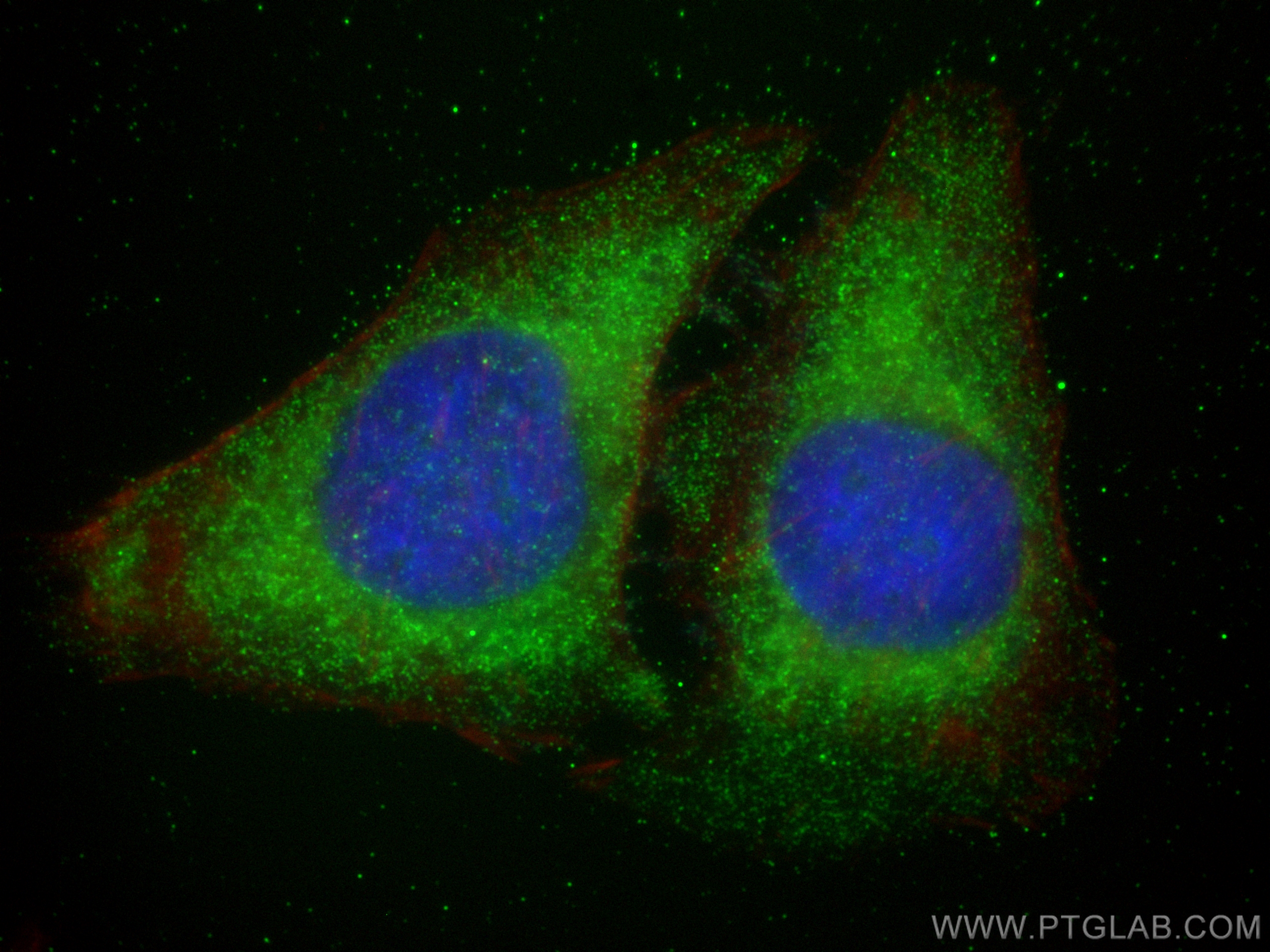 Immunofluorescence (IF) / fluorescent staining of HeLa cells using WNT4 Polyclonal antibody (14371-1-AP)