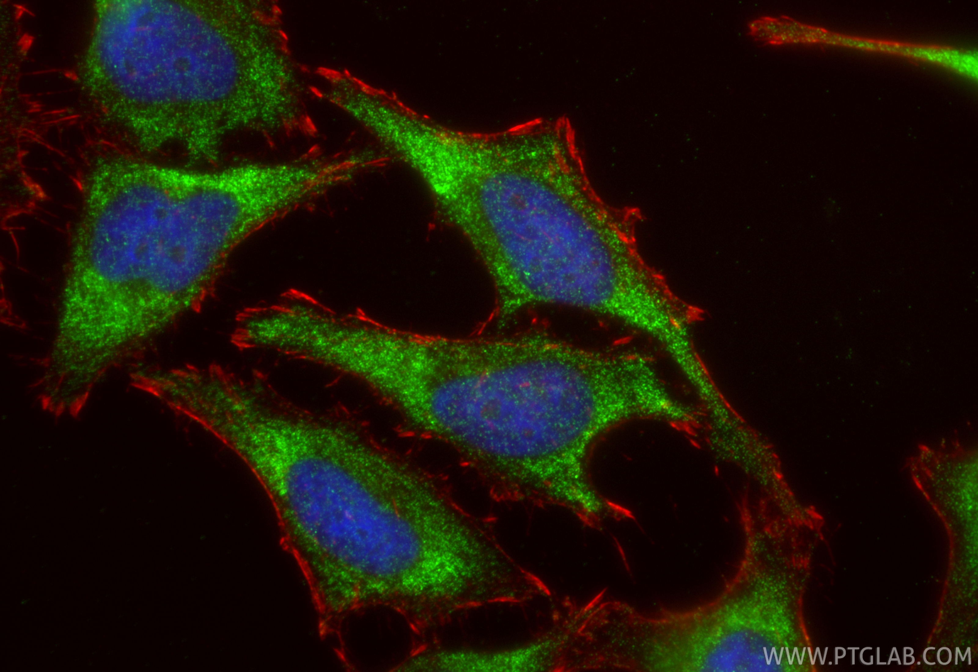 Immunofluorescence (IF) / fluorescent staining of HeLa cells using WNT5A/B Polyclonal antibody (29793-1-AP)