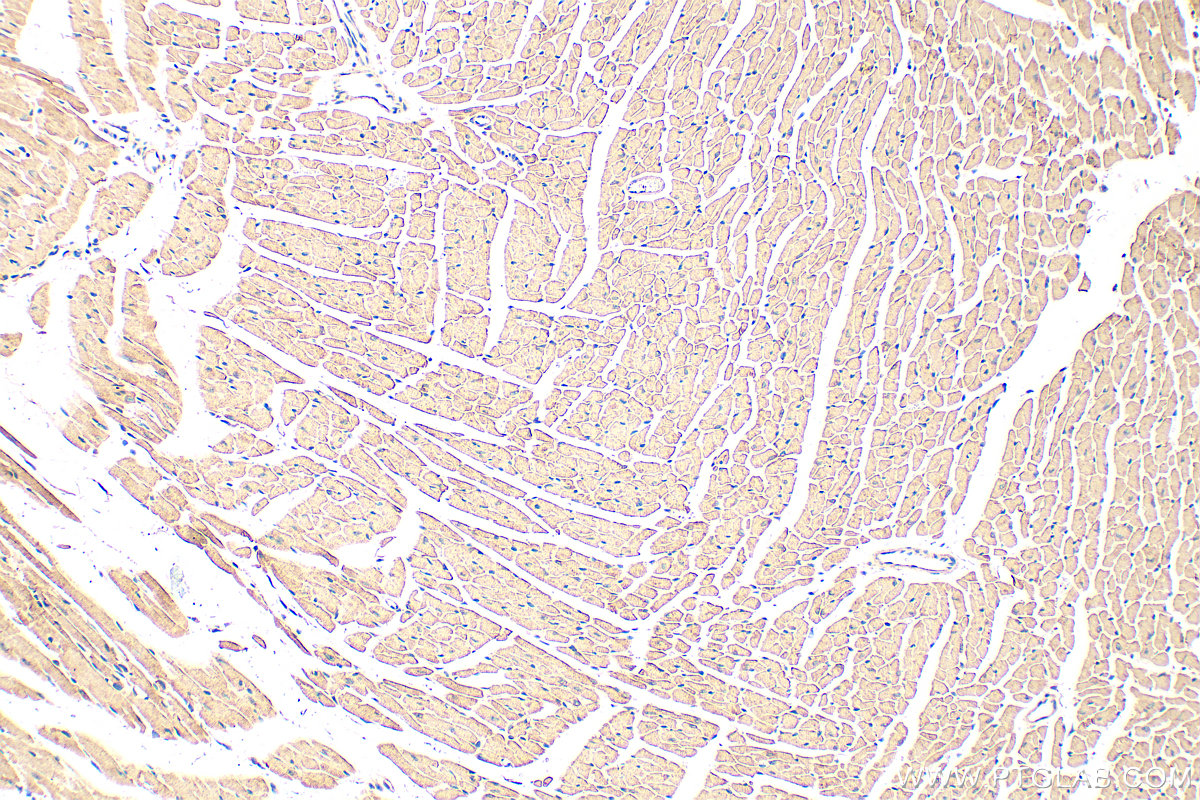 Immunohistochemistry (IHC) staining of mouse heart tissue using WNT5A/B Polyclonal antibody (55184-1-AP)