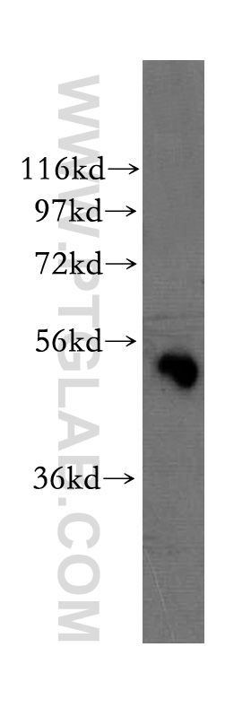 Western Blot (WB) analysis of human brain tissue using WSB2 Polyclonal antibody (12124-2-AP)