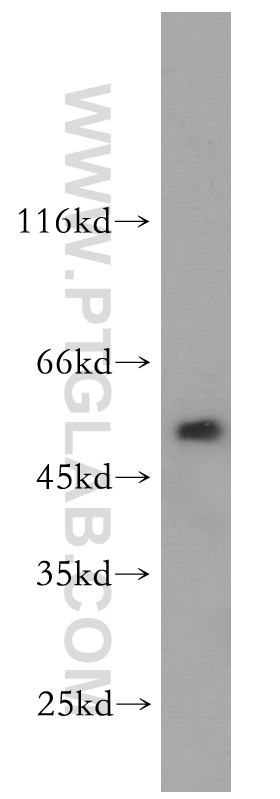 Western Blot (WB) analysis of mouse kidney tissue using WSB2 Polyclonal antibody (12124-2-AP)