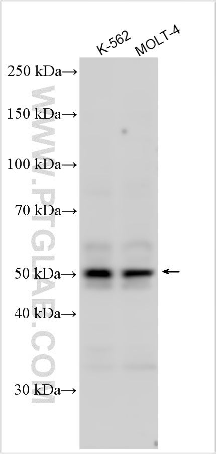 Western Blot (WB) analysis of various lysates using WT1 Polyclonal antibody (12609-1-AP)