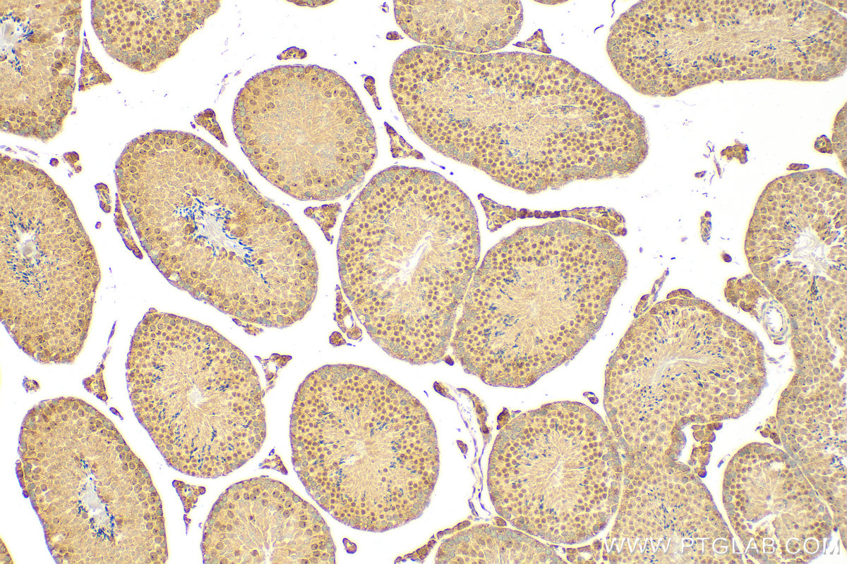 Immunohistochemistry (IHC) staining of mouse testis tissue using WT1 Recombinant antibody (82525-1-RR)