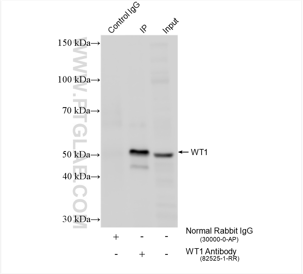 Immunoprecipitation (IP) experiment of K-562 cells using WT1 Recombinant antibody (82525-1-RR)