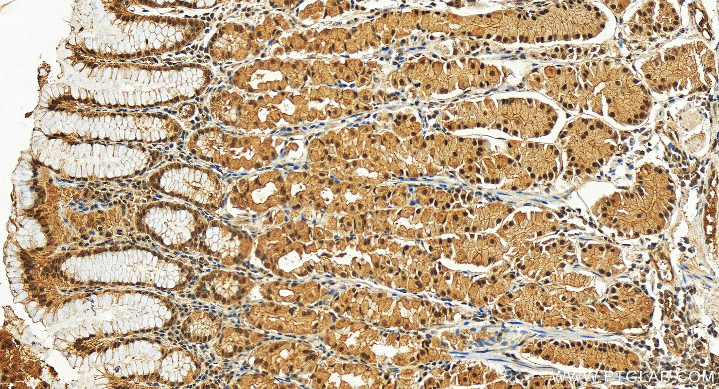 Immunohistochemistry (IHC) staining of human stomach tissue using WTAP Polyclonal antibody (10200-1-AP)