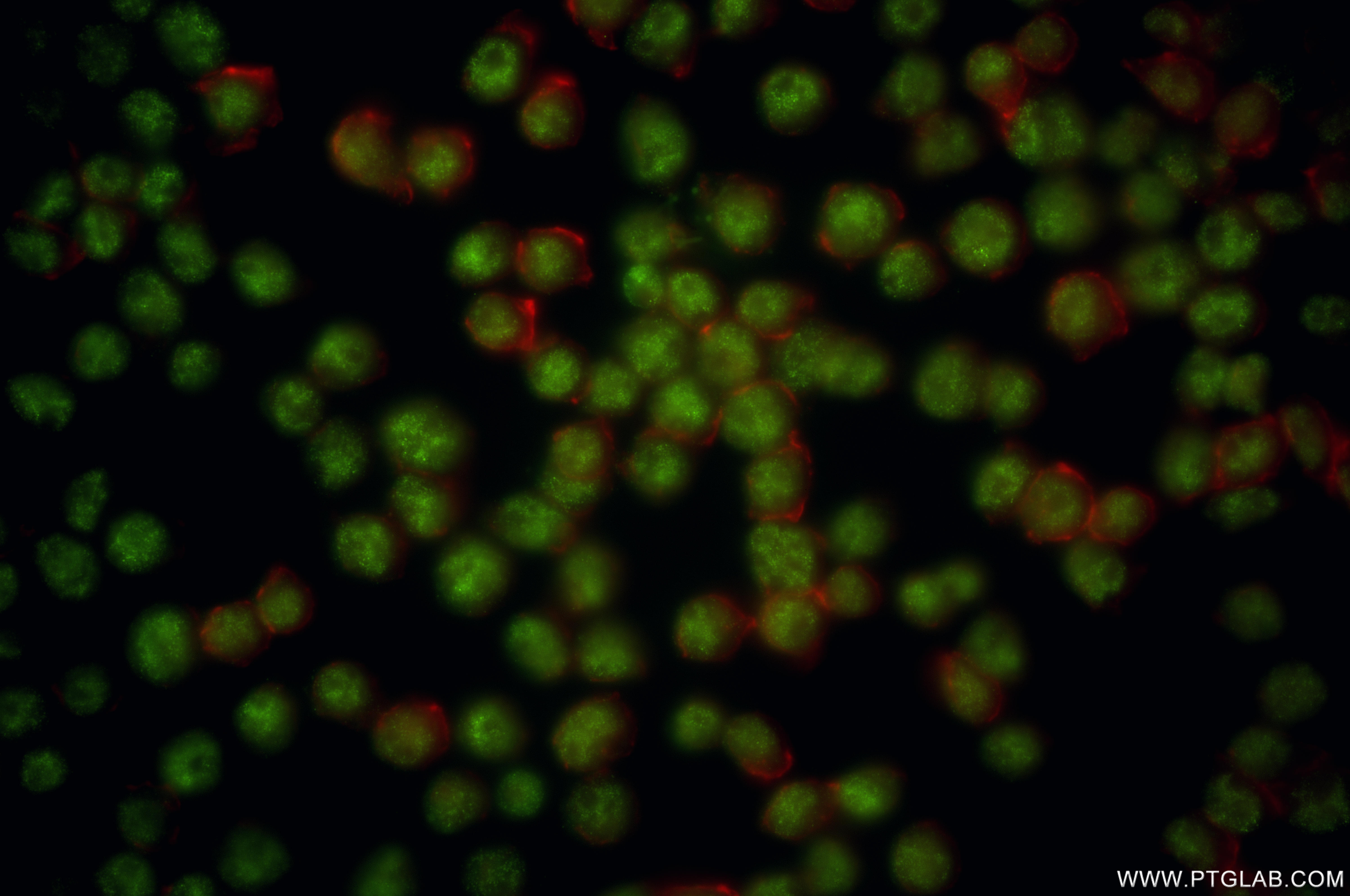 Immunofluorescence (IF) / fluorescent staining of Jurkat cells using WTAP Recombinant antibody (81987-4-RR)