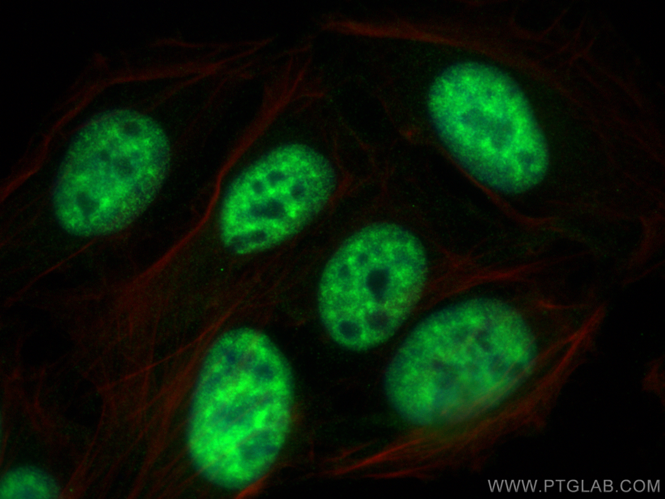 Immunofluorescence (IF) / fluorescent staining of U2OS cells using XAB2 Polyclonal antibody (10637-1-AP)