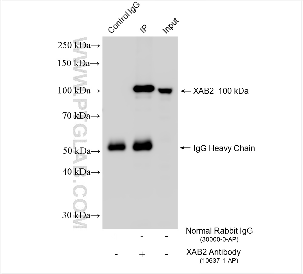 Immunoprecipitation (IP) experiment of K-562 cells using XAB2 Polyclonal antibody (10637-1-AP)