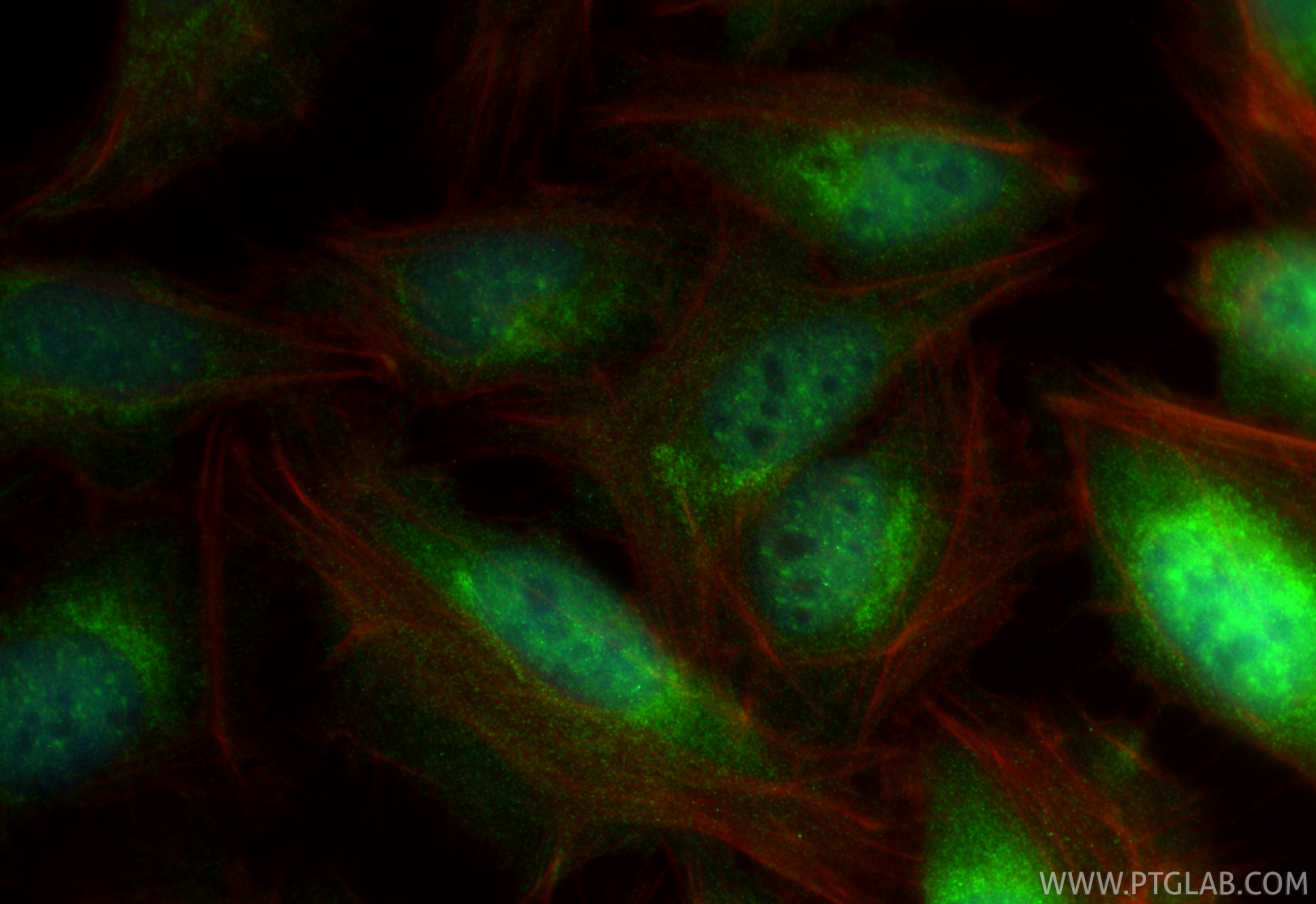 Immunofluorescence (IF) / fluorescent staining of U2OS cells using XBP1S-specific Polyclonal antibody (24868-1-AP)