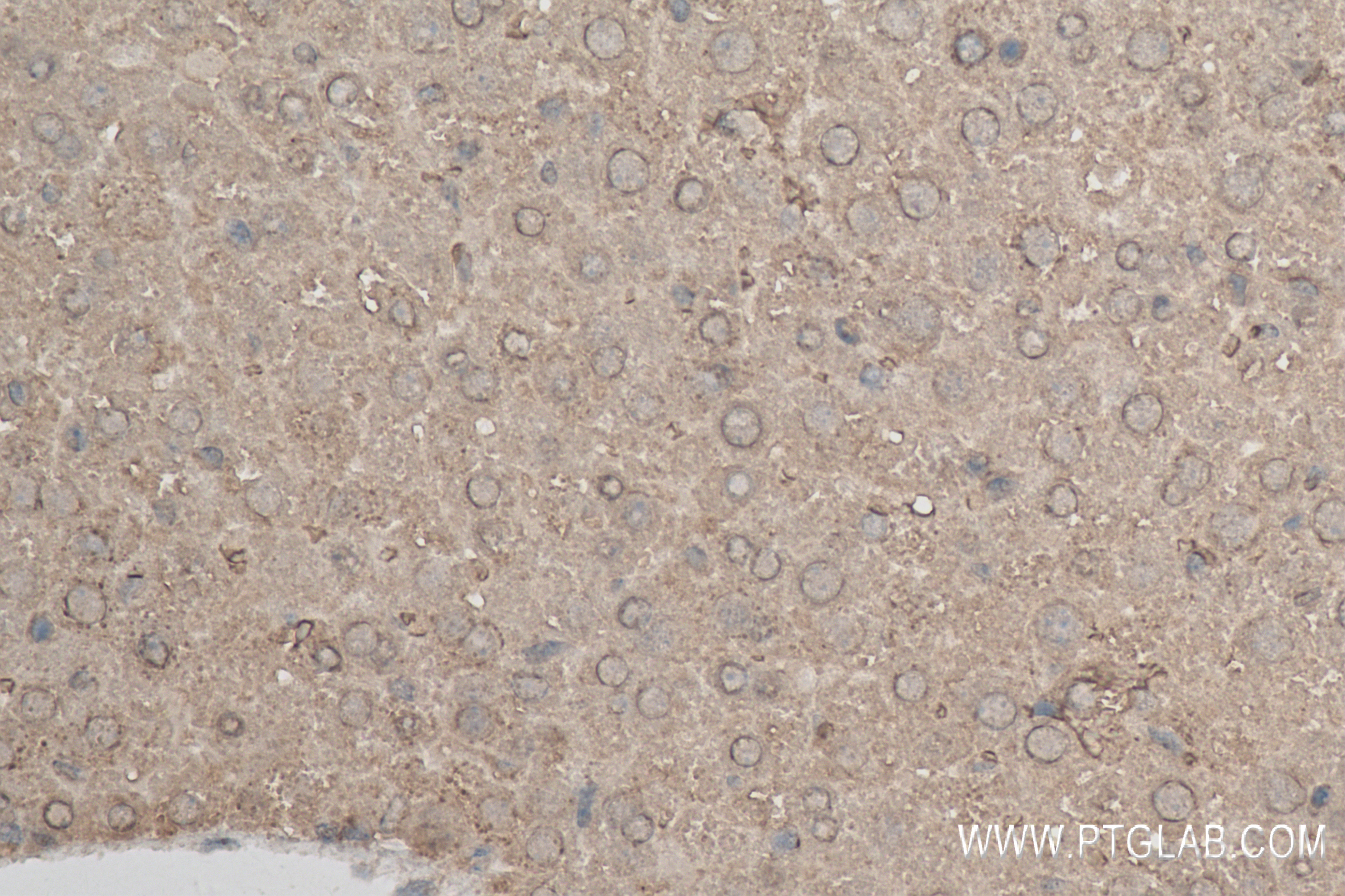 Immunohistochemistry (IHC) staining of mouse liver tissue using XBP1S-specific Recombinant antibody (83959-5-RR)