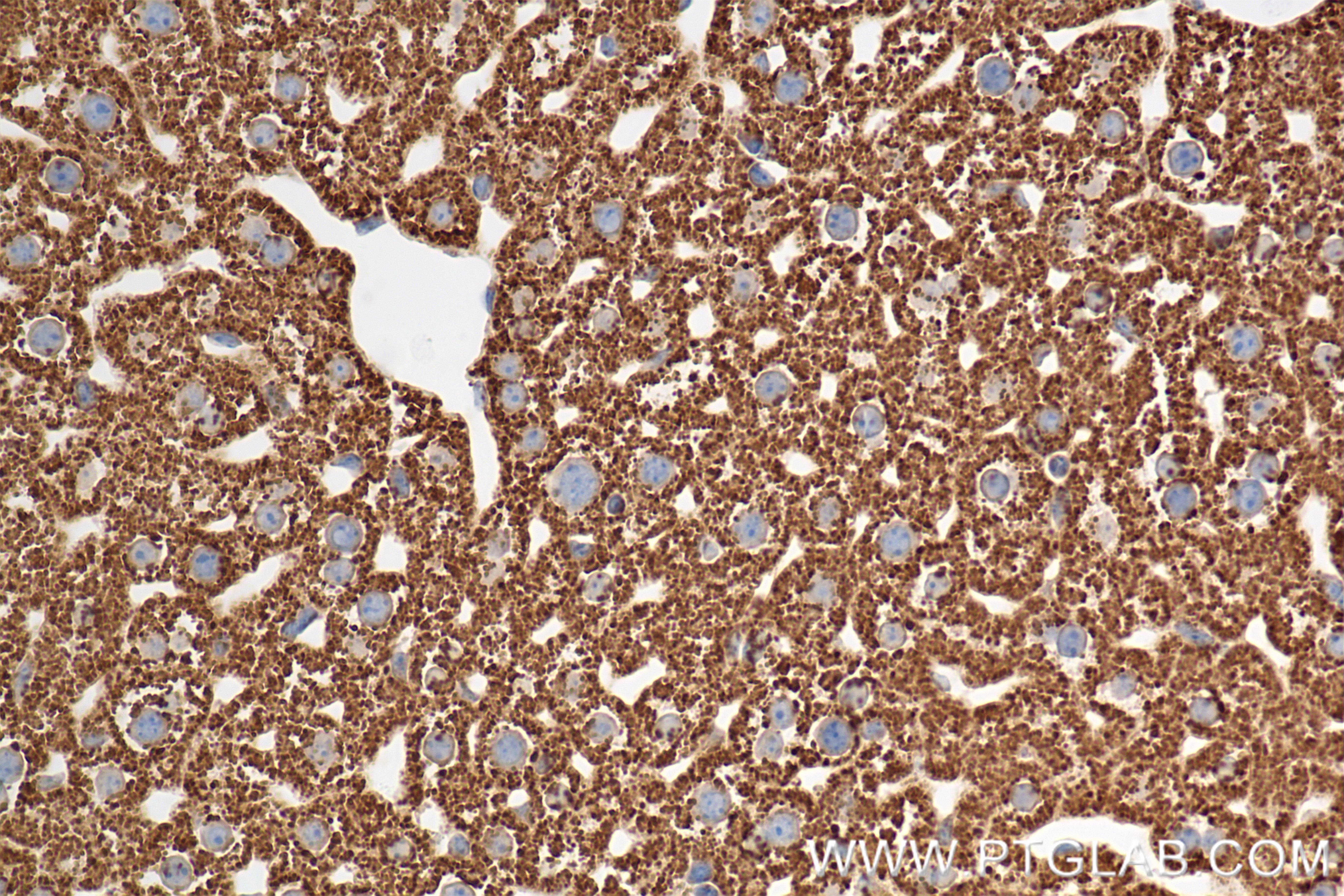 Immunohistochemistry (IHC) staining of mouse liver tissue using XBP1S-specific Recombinant monoclonal antibody (83959-5-RR)