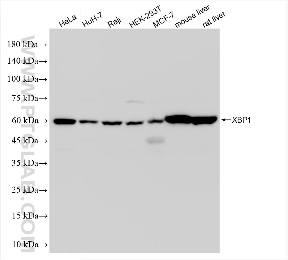 Western Blot (WB) analysis of various lysates using XBP1S-specific Recombinant antibody (83959-5-RR)