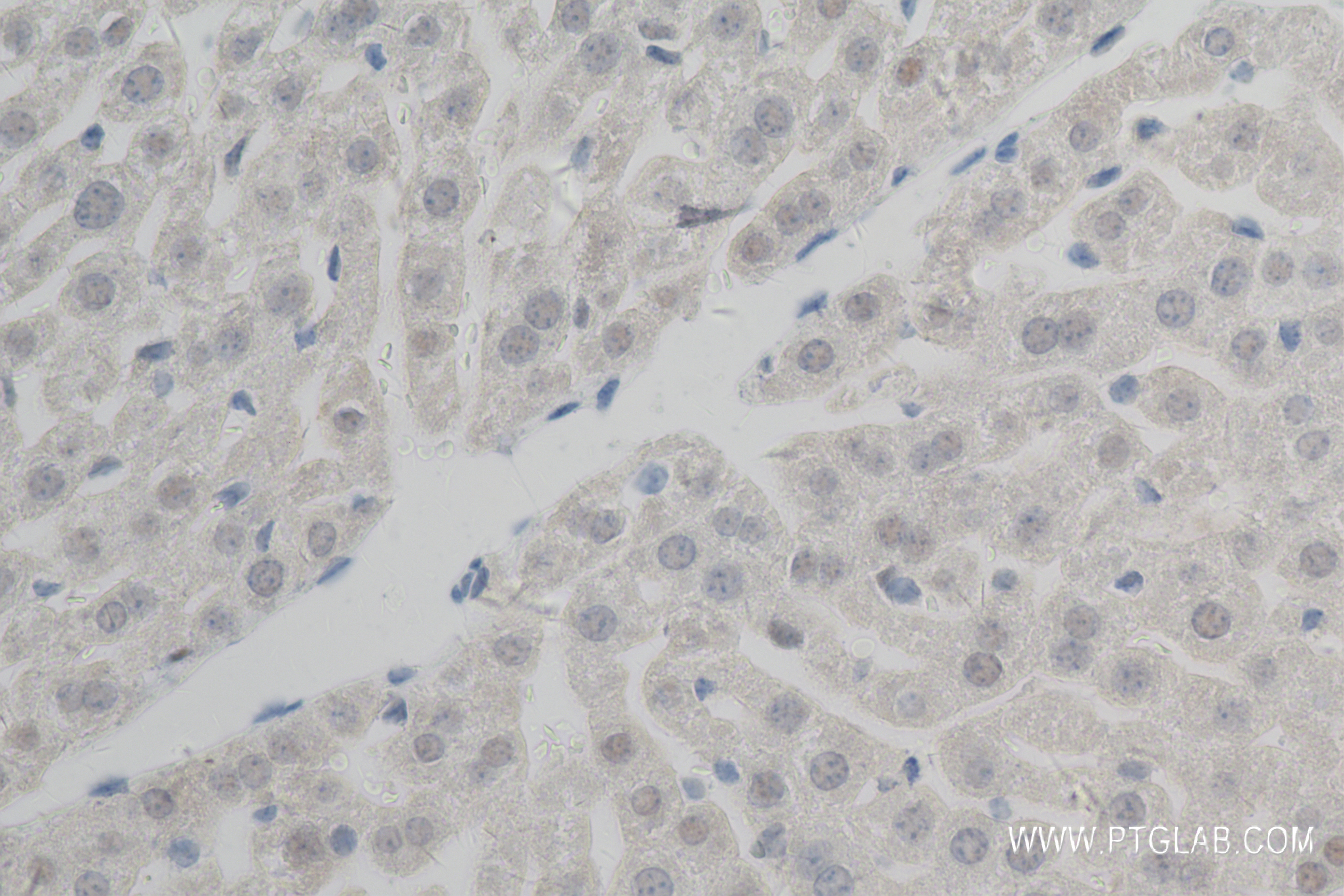 Immunohistochemistry (IHC) staining of mouse liver tissue using XBP1S-specific Recombinant antibody (83959-6-RR)