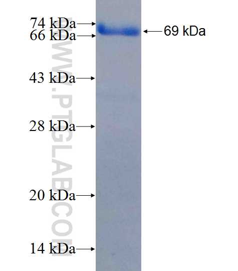 XPA fusion protein Ag26249 SDS-PAGE