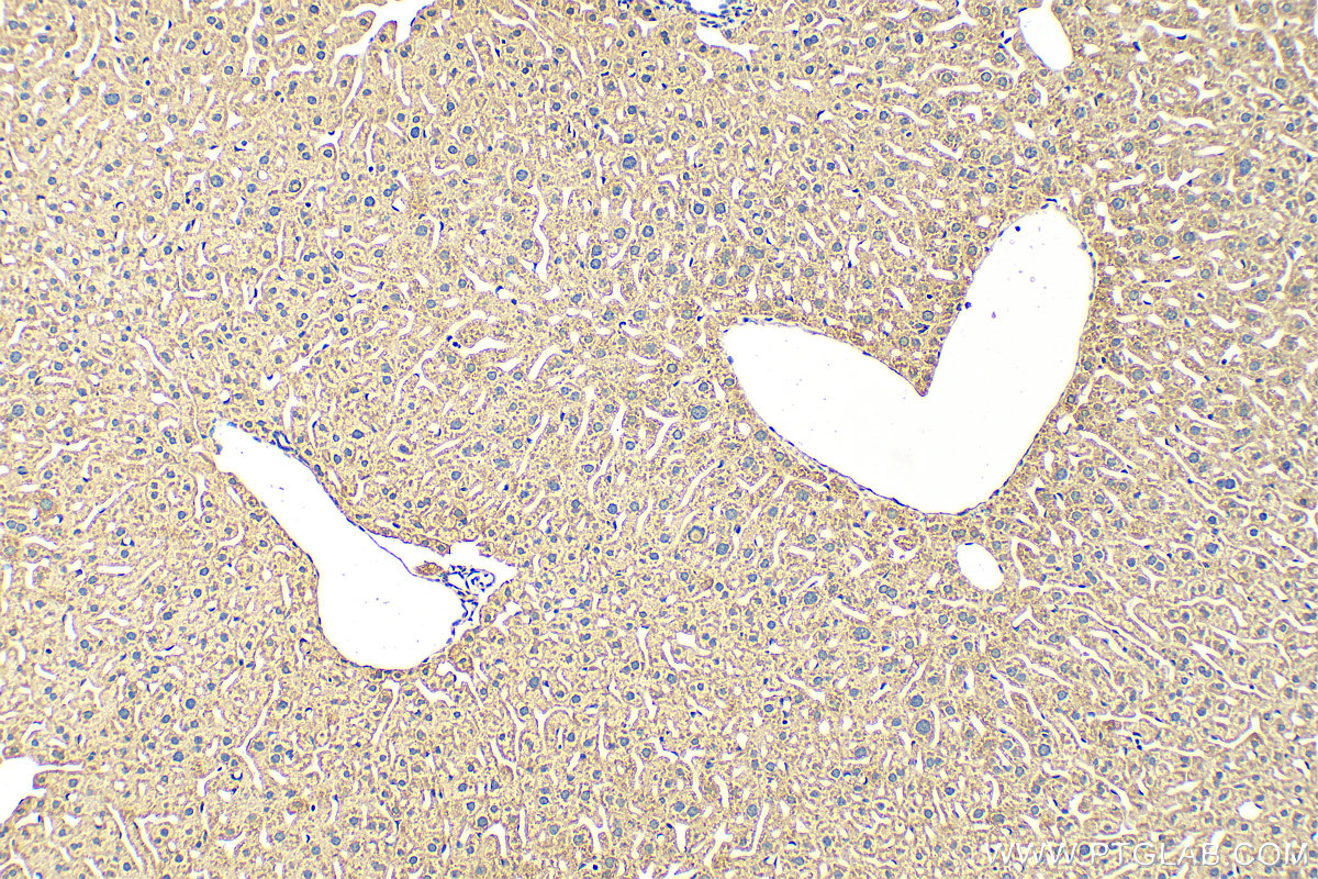 Immunohistochemistry (IHC) staining of mouse liver tissue using XPNPEP3 Polyclonal antibody (15655-1-AP)