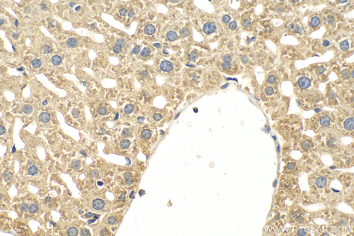 Immunohistochemistry (IHC) staining of mouse liver tissue using XPNPEP3 Polyclonal antibody (15655-1-AP)