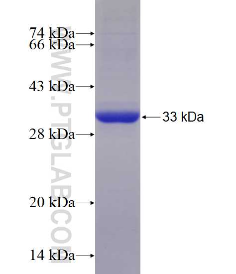 XPR1 fusion protein Ag5731 SDS-PAGE