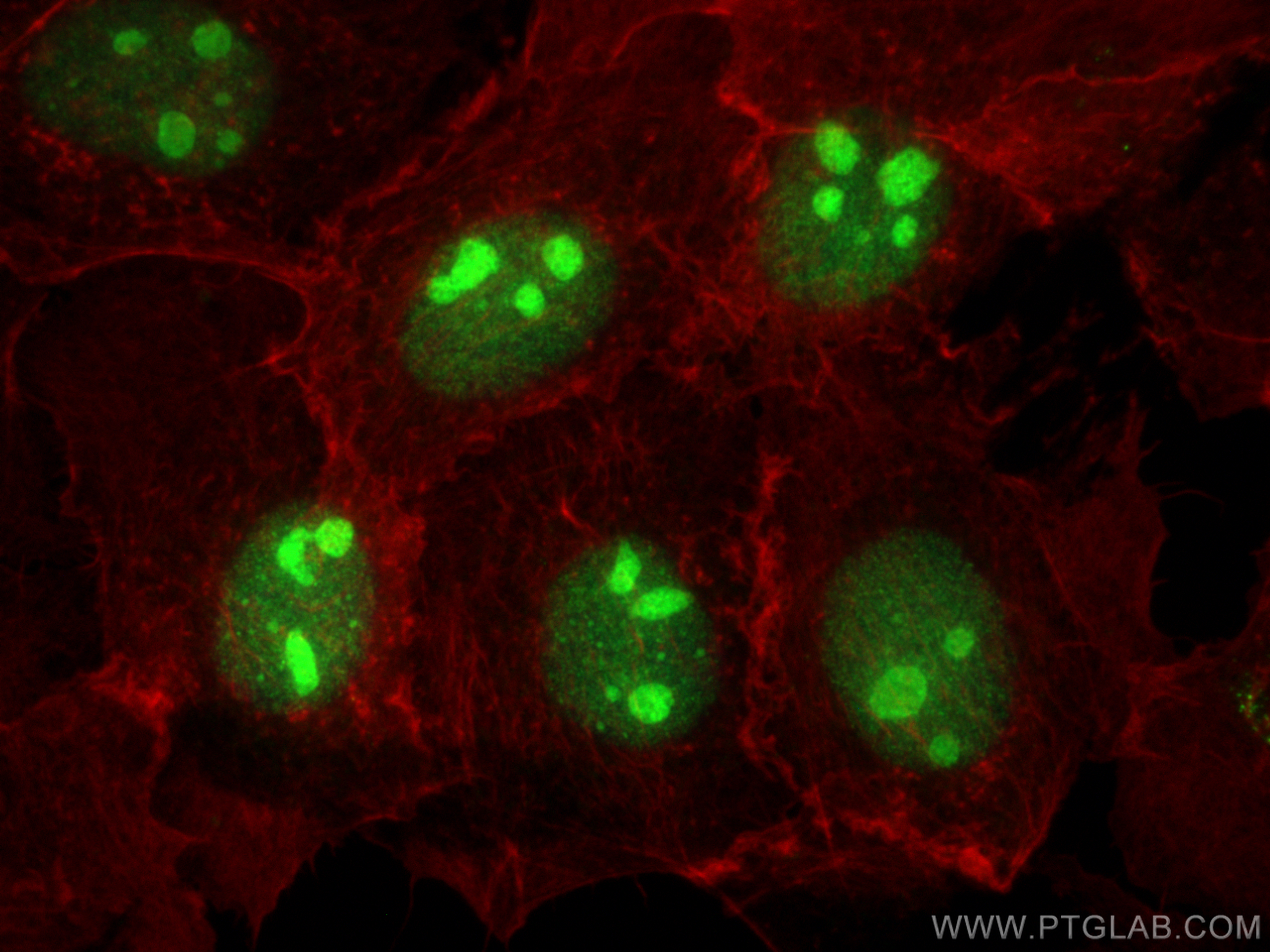 Immunofluorescence (IF) / fluorescent staining of A431 cells using XRCC1 Polyclonal antibody (21468-1-AP)