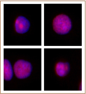 XRCC1 antibody (pAb) tested by Immunofluorescence. Formaldehyde fixed HeLa cells stained with XRCC1 antibody at a 1:2,000 dilution.